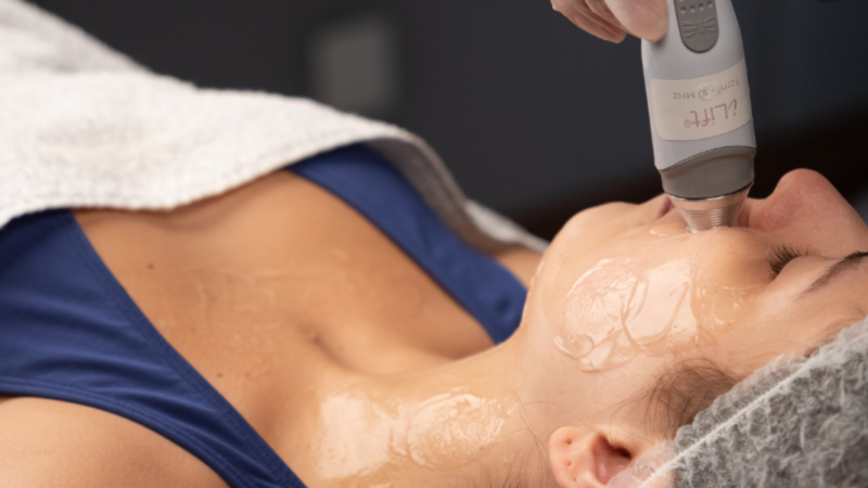 Ultrassom terapêutico avança no rejuvenescimento facial