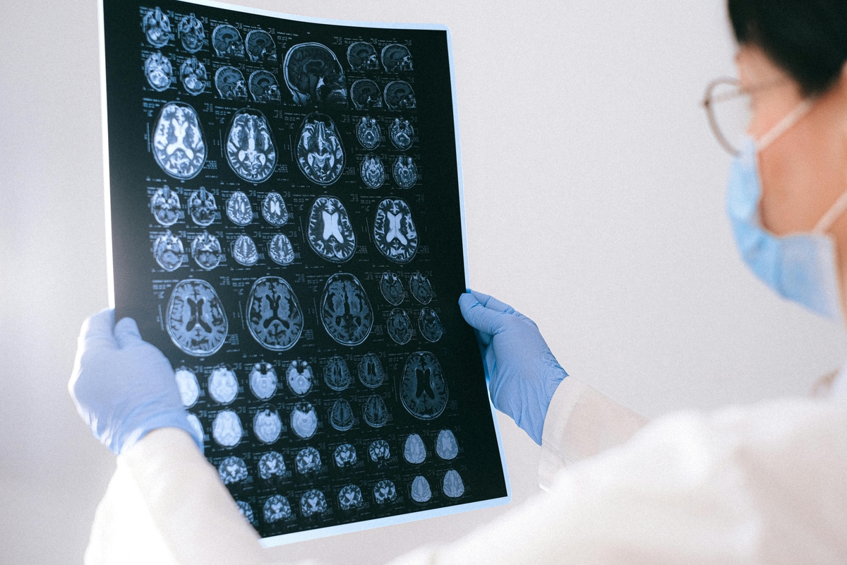 BrainAge: tecnologia indica a idade cerebral
