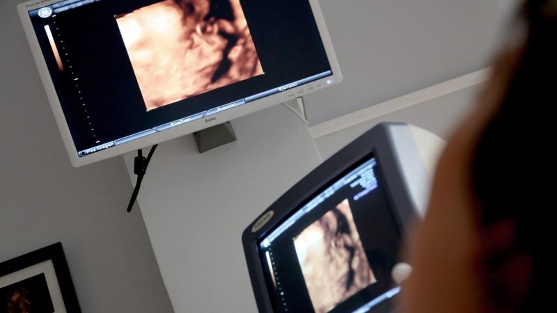 Pesquisa reforça técnica fetal para hérnia diafragmática