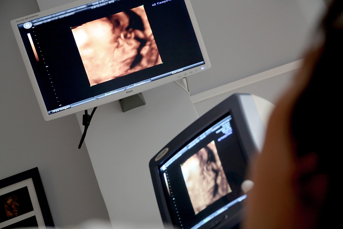 Pesquisa reforça técnica fetal para hérnia diafragmática